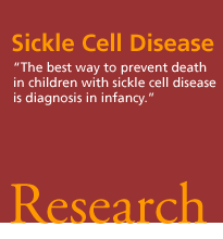 Sickle Cell Disease. 'The best way to prevent death in children with sickle cell disease is diagnosis in infancy.' Research.